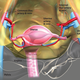 Image: Cleveland Clinic.